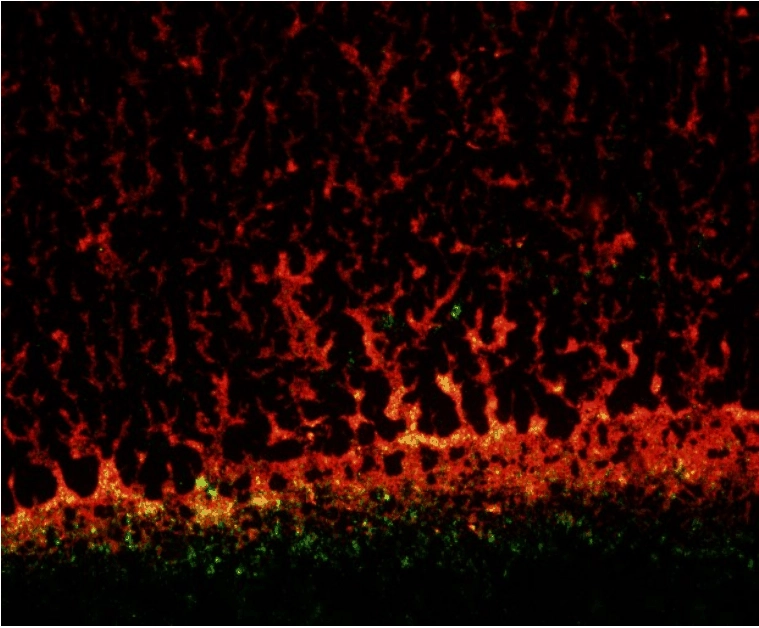 Caracterización de las propiedades antibiofilm en superficies