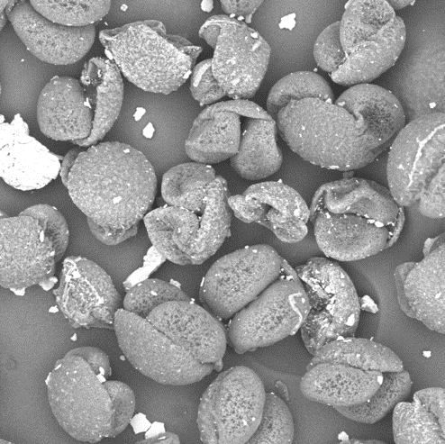 Study of the final quality of a food Micrografía SEM de microorganismos depositados sobre una superficie