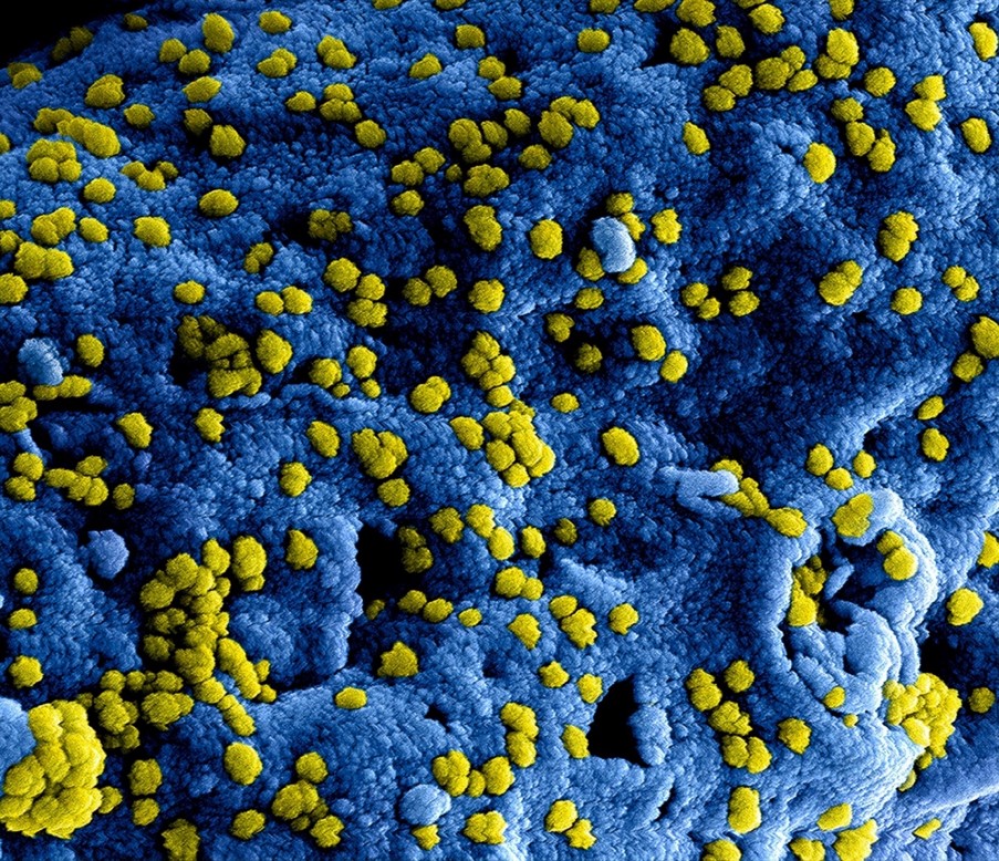 Micrografía coloreada de microorganismos adheridos a una superficie plástica durante el ensayo de un nuevo aditivo antimicrobiano