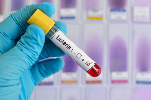 listeria laboratorio