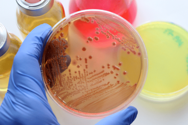 The importance of food microbiology in quality processes