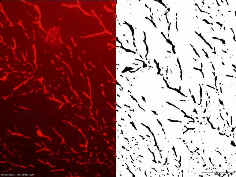 Desarrollo de un método cuantitativo de análisis de biofilm mediante procesamiento de imágenes Micrografía de fluorescencia de un biofilm junto a su imagen binarizada, base del método cuantitativo de análisis por procesamiento de imagen