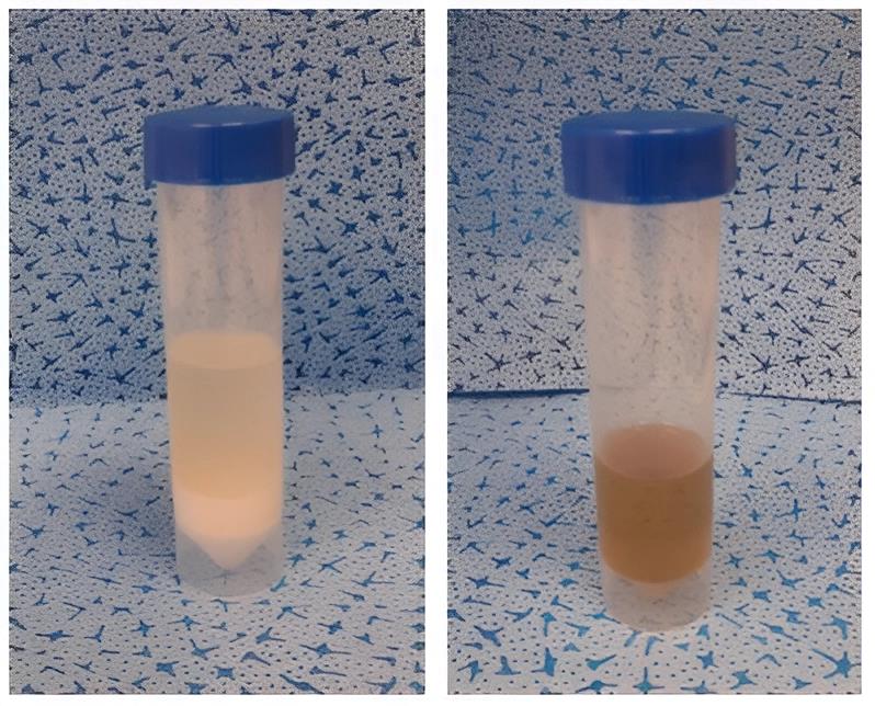 Fluid Analysis in Production for Cost Reduction and Sustainability Improvement