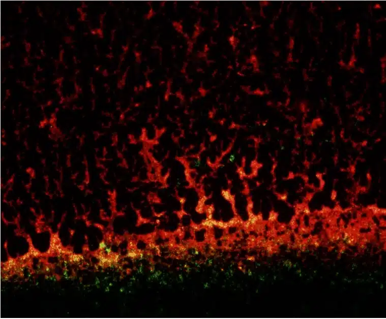 Characterization of the antibiofilm properties of surfaces Biofilm on a surface observed by fluorescence microscopy