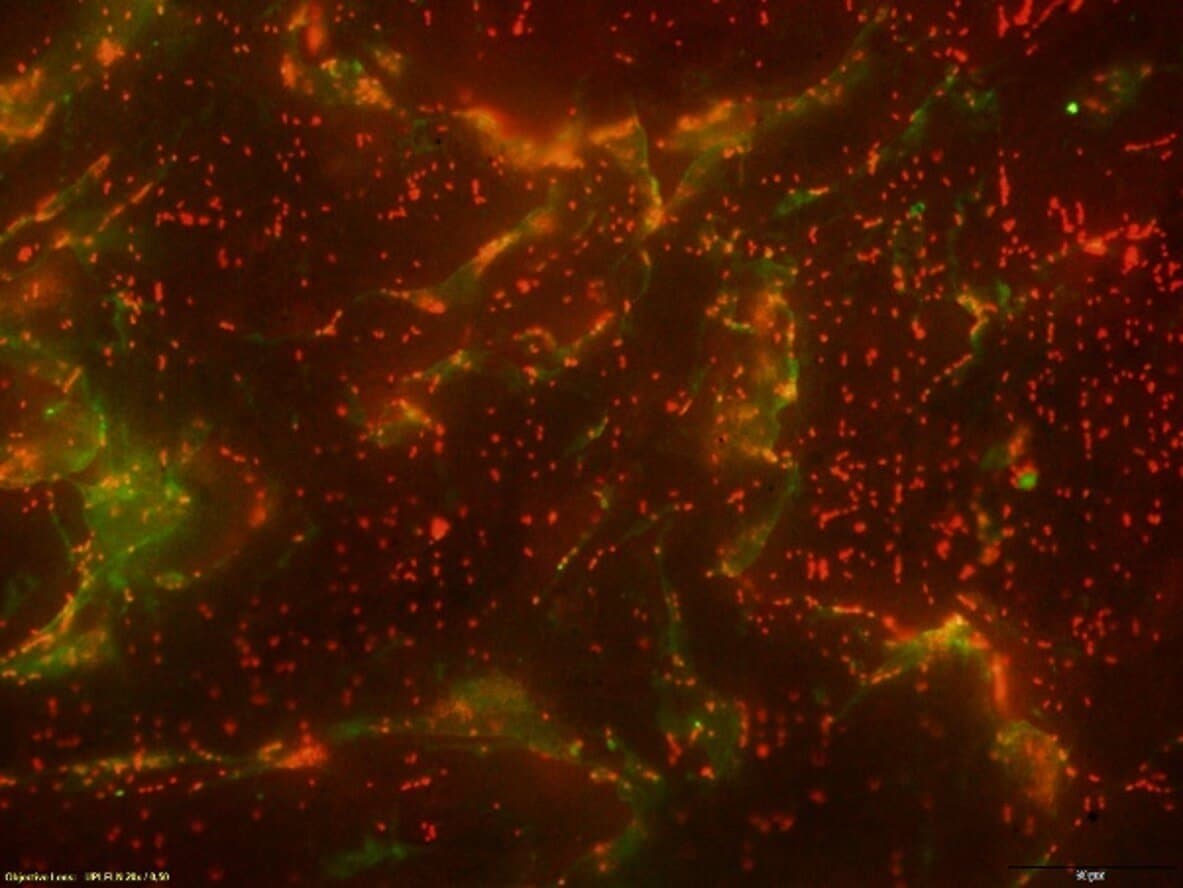 Development of a method for simultaneous analysis of biofilm and extracellular matrix