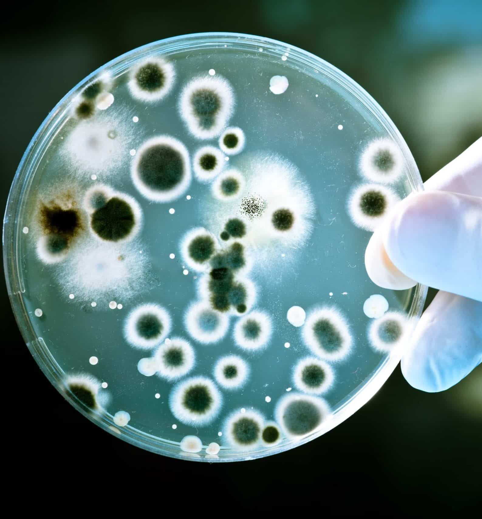 Ensayos de microbiología y eficacia antimicrobiana en placa