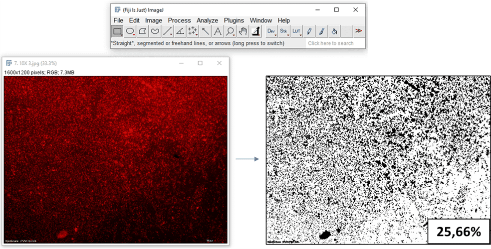 Development of a quantitative method for biofilm analysis using image processing. Development of a quantitative method for biofilm analysis using image processing.