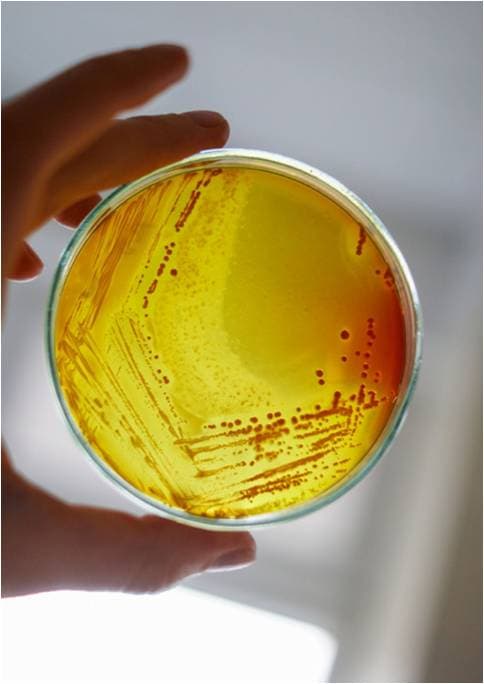 Hygiene map. Study of microorganisms in cars Petri dish with bacterial colonies grown from samples taken inside a car